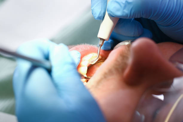 Best Orthodontic Emergency Dentist in Allegan, MI