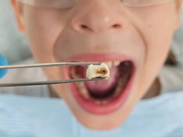 Best Pediatric Emergency Dentist in Allegan, MI